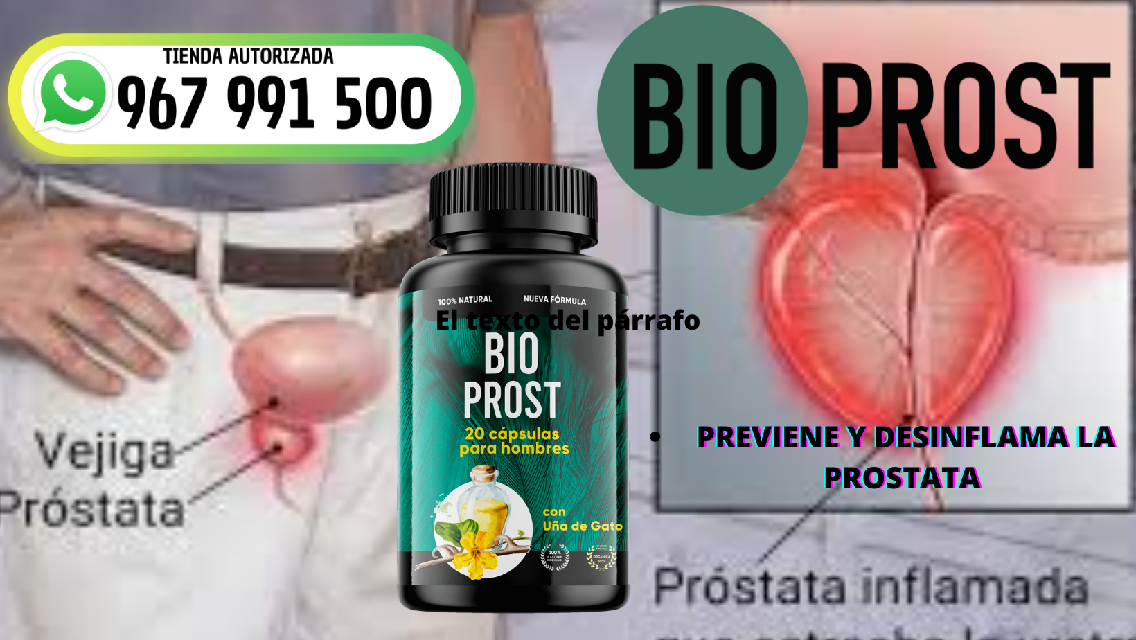 BIOPROST